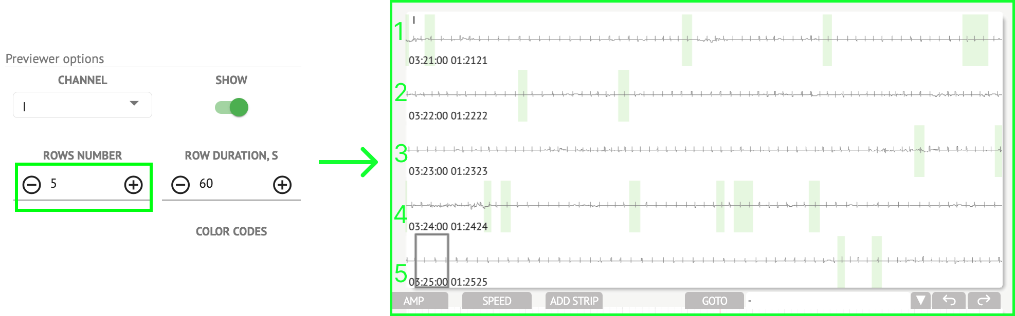 CardioAI Support. ECG data anal
ysing - image37
