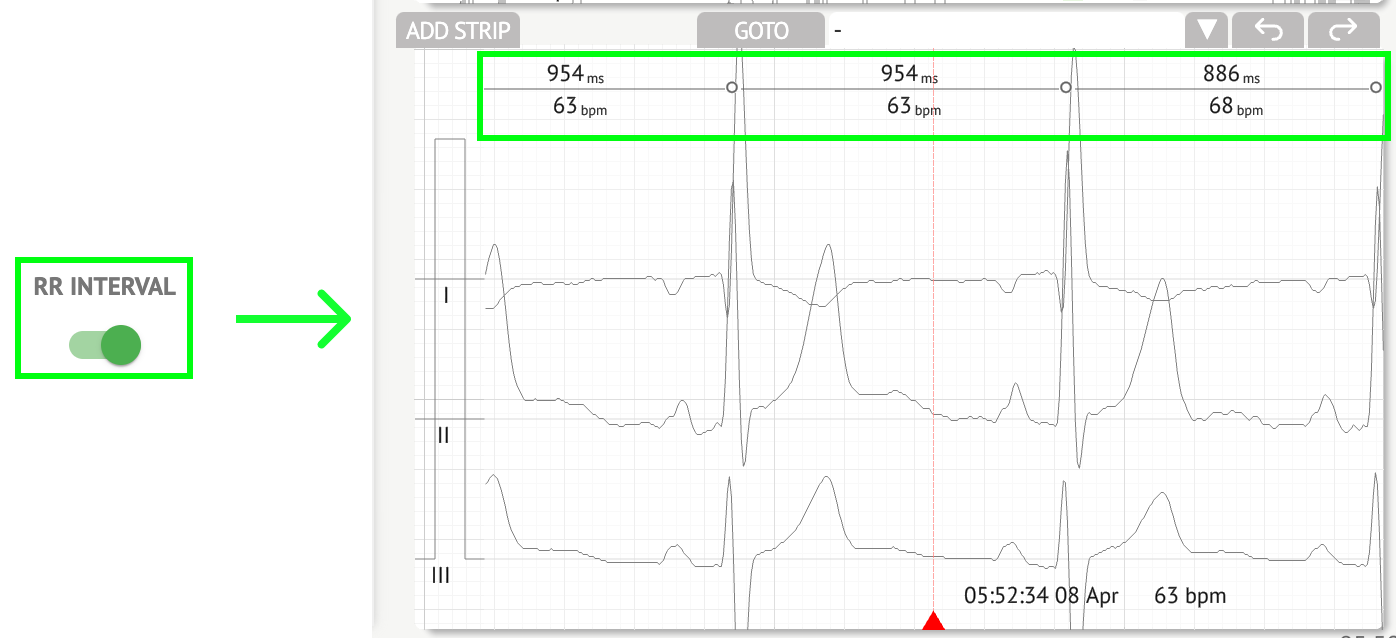 CardioAI Support. ECG data anal
ysing - image88