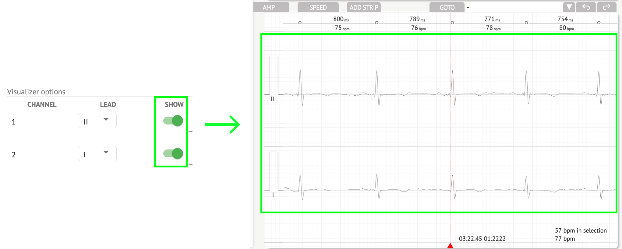 CardioAI Support. ECG data anal
ysing - image93
